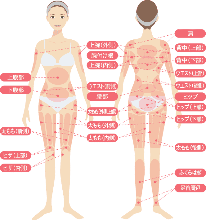 脂肪吸引対象部位の一覧画像