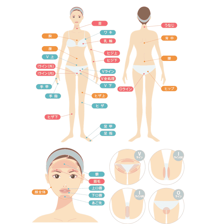 医療脱毛、可能範囲図