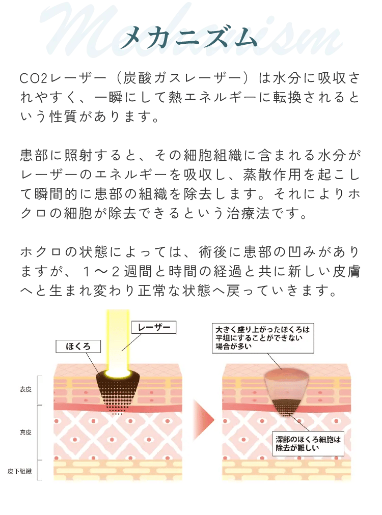 CO2ガスレーザー メカニズム