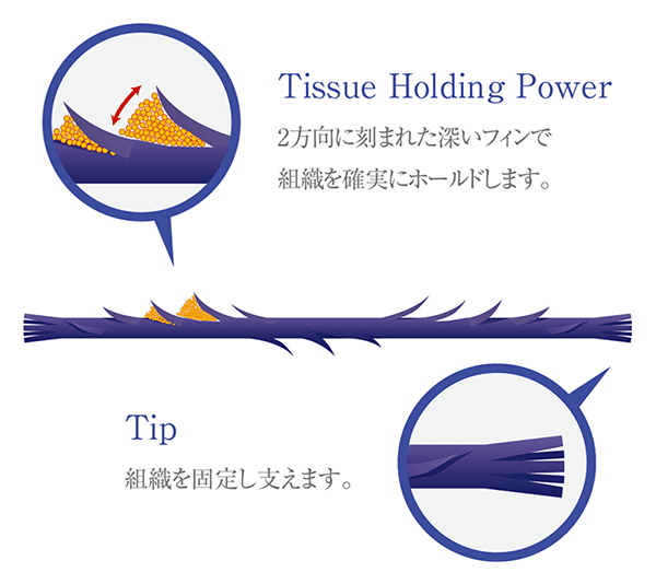 フレックスノーズ(クレオパトラノーズ)の特徴図解