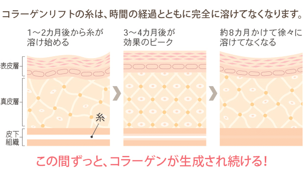 治療後の経過イメージ